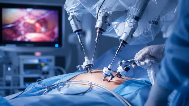 Laparoscopic & Robotic Partial Nephrectomy illustration